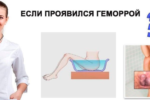 Не зачисляются деньги на кракен